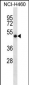 SOCS4 Antibody (Center)